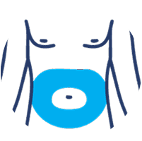 Outline graphic of a silhouette with the abdomen area shaded blue